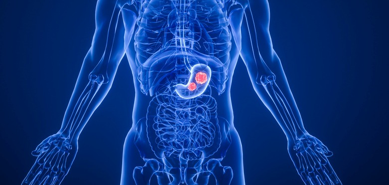 4个月治疗迎来治愈希望,18人多学科团队护航!一位中国癌症患者的赴美治愈之路